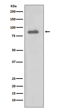 IKK alpha Rabbit mAb [KD Validated]