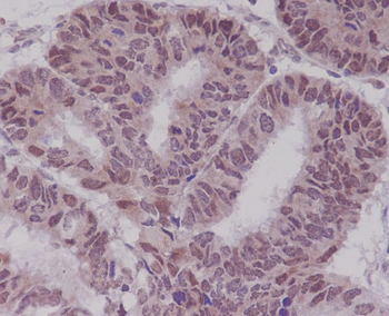 BTK Rabbit mAb Antibody