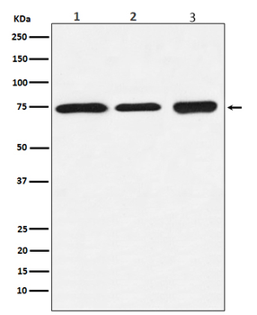 BTK Rabbit mAb Antibody