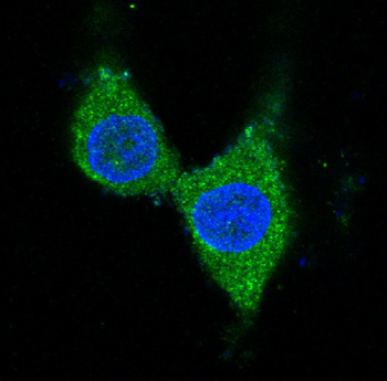 Tyrosine Hydroxylase Rabbit mAb Antibody
