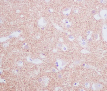 Tyrosine Hydroxylase Rabbit mAb