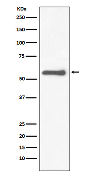 Tyrosine Hydroxylase Rabbit mAb