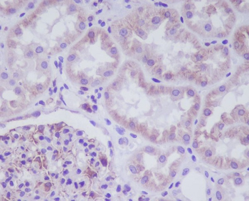 ADIPOR1 Rabbit mAb [KD Validated]