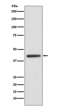 ADIPOR1 Rabbit mAb [KD Validated]