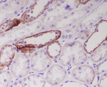 JAG1 Rabbit mAb Antibody