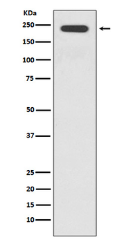 JAG1 Rabbit mAb Antibody