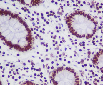 TOP1 Rabbit mAb Antibody