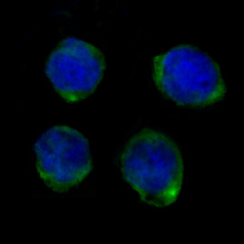 CD14 Rabbit mAb Antibody