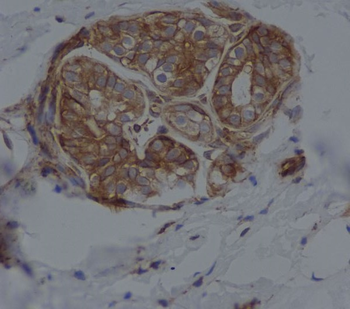 CD14 Rabbit mAb Antibody