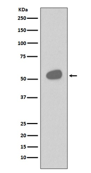CD14 Rabbit mAb Antibody