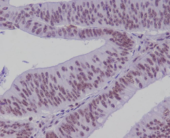 TCF7L2 Rabbit mAb Antibody