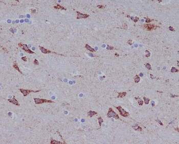 Glutaminase Rabbit mAb Antibody