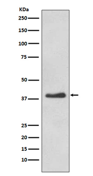 DKK1 Rabbit mAb