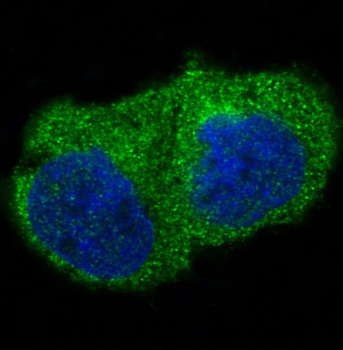 ILK Rabbit mAb Antibody