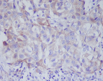 VAV2 Rabbit mAb Antibody