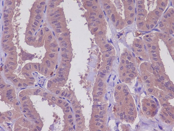 MEKK2 Rabbit mAb Antibody
