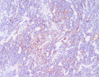 CD21 Rabbit mAb Antibody