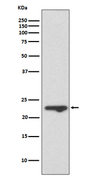 MUC1 Rabbit mAb Antibody