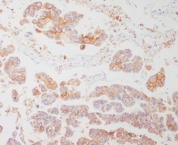 HLA-DRA Rabbit mAb Antibody