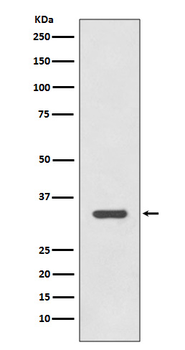 HLA-DRA Rabbit mAb Antibody