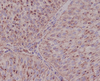 ASNS Rabbit mAb Antibody
