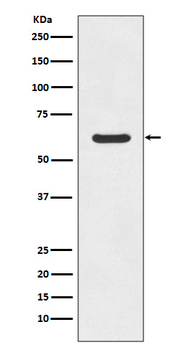 ASNS Rabbit mAb