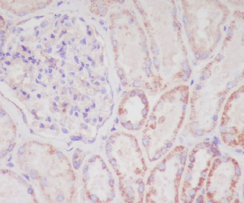 Smac/Diablo Rabbit mAb Antibody