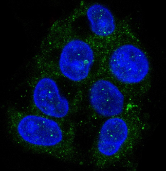 ATG9A Rabbit mAb [KD Validated]