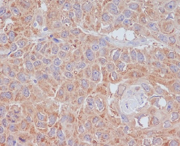 ATG9A Rabbit mAb [KD Validated]