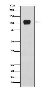 ATG9A Rabbit mAb [KD Validated]