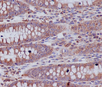 ABCF1 Rabbit mAb Antibody