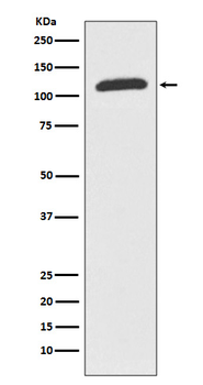 ABCF1 Rabbit mAb Antibody