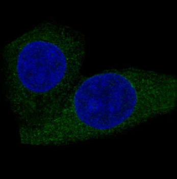 CPT2 Rabbit mAb Antibody