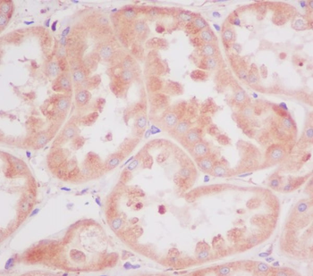 RPS20 Rabbit mAb Antibody