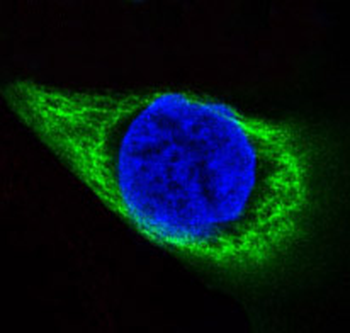 Cytokeratin 14 Rabbit mAb Antibody