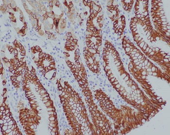 Cytokeratin 14 Rabbit mAb Antibody