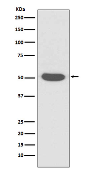 Cytokeratin 14 Rabbit mAb Antibody