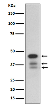 cleaved Caspase-9 Rabbit mAb [KD Validated]