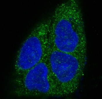 MyD88 Rabbit mAb Antibody
