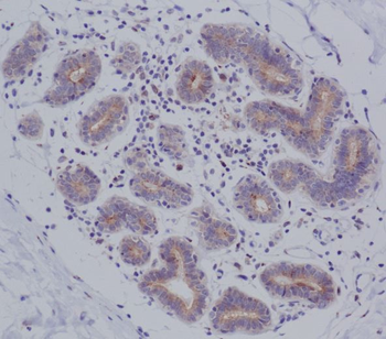 MyD88 Rabbit mAb Antibody