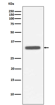 MyD88 Rabbit mAb Antibody