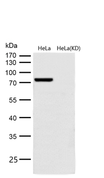 GARS Rabbit mAb Antibody