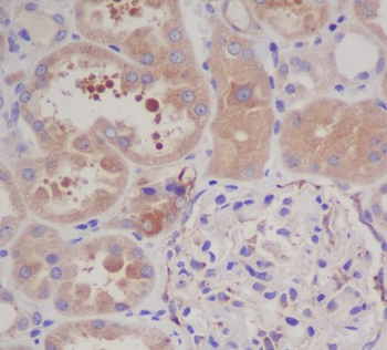 GARS Rabbit mAb Antibody