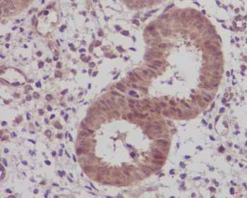 IKB beta Rabbit mAb Antibody