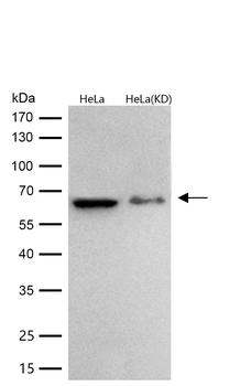 IRAK3 Rabbit Monoclonal Antibody