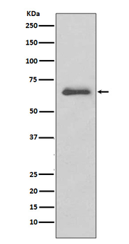IRAK3 Rabbit Monoclonal Antibody