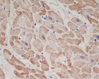 Troponin T Rabbit Monoclonal Antibody