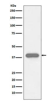 Troponin T Rabbit Monoclonal Antibody
