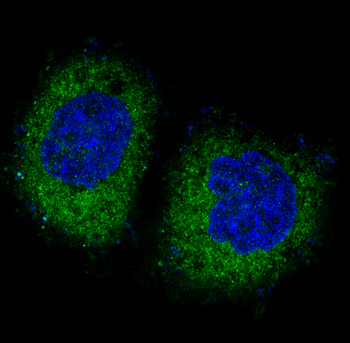 PKR Rabbit mAb Antibody