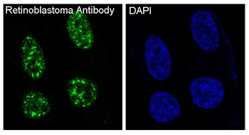 Retinoblastoma Rabbit mAb Antibody